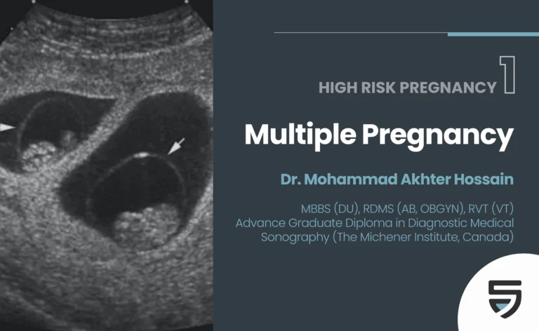 High Risk Pregnancy 1 – Multiple Pregnancy