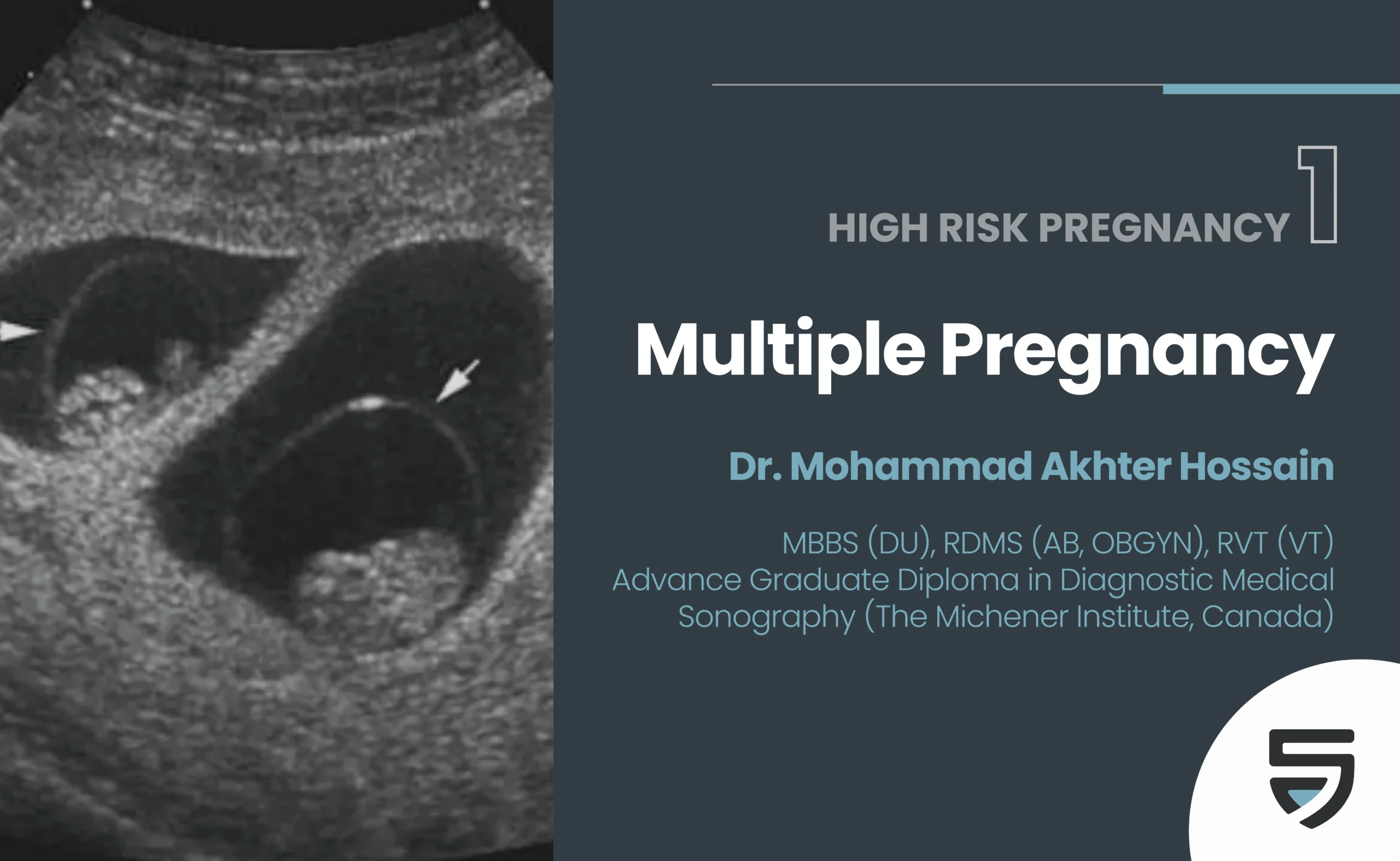 High Risk Pregnancy 1 – Multiple Pregnancy – Shristy Access