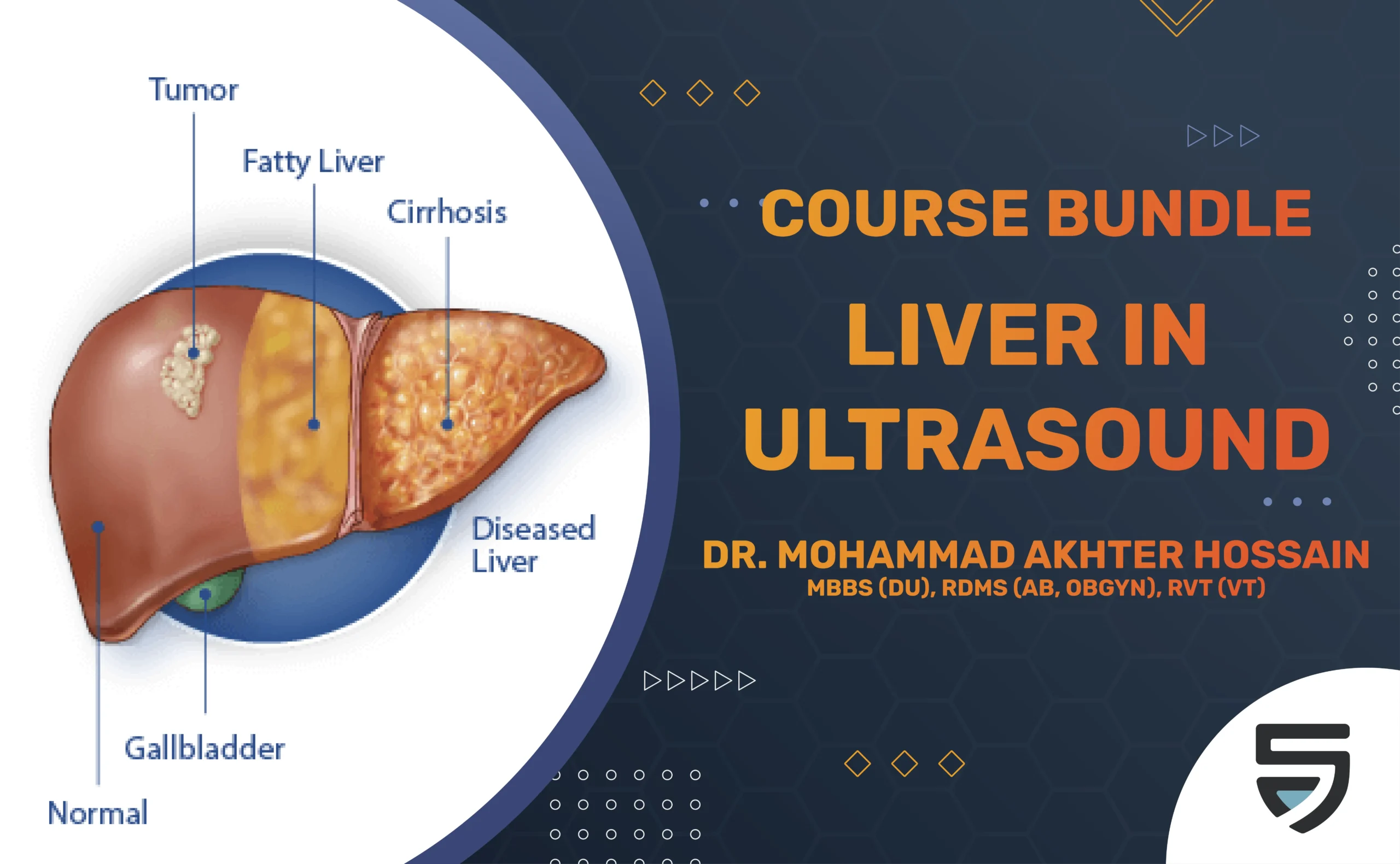 Liver in Ultrasound